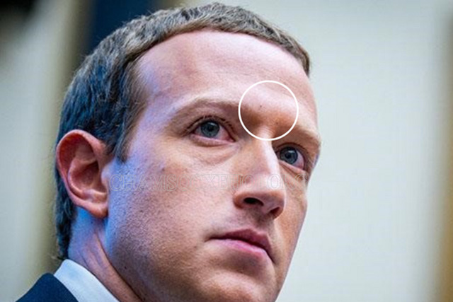 Ấn đường nhô cao của Mark Zuckerberg